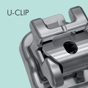 U-Clip