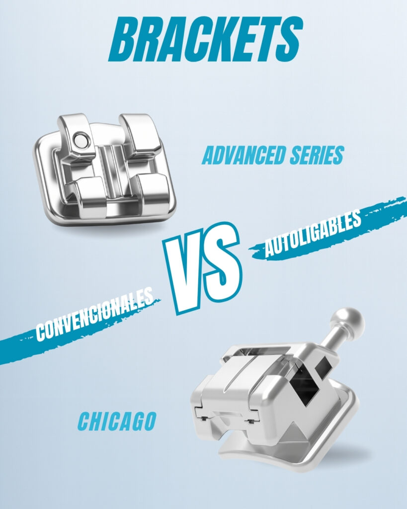 Brackets convencionales Chicago vs brackets autoligables Advanced de FIX Orthodontics