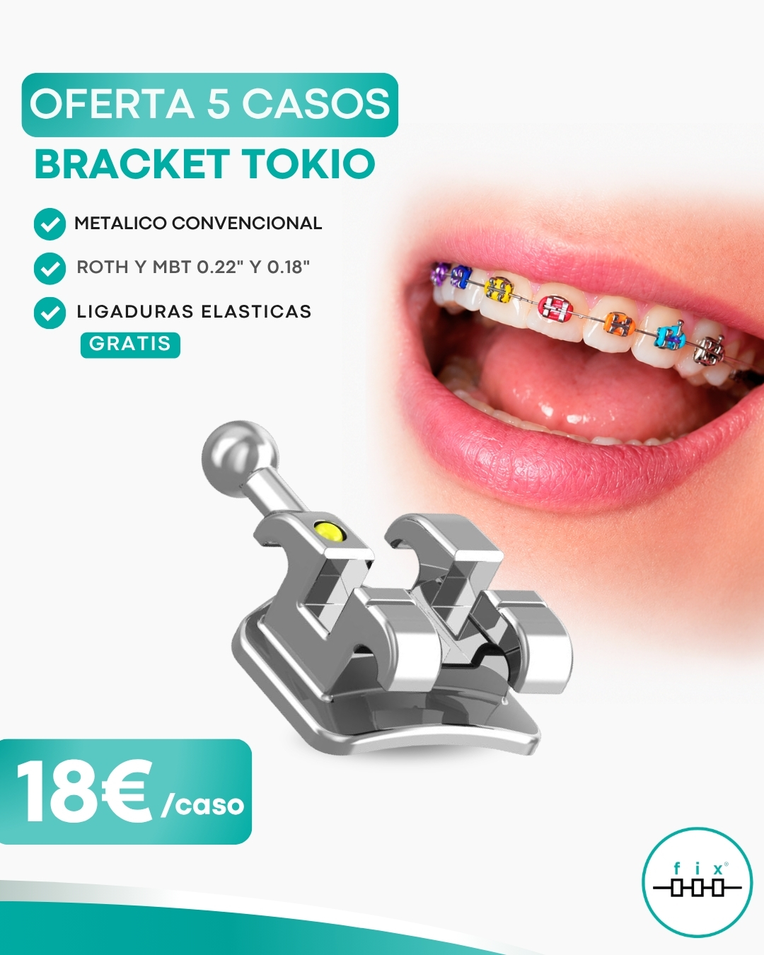 Oferta Brackets Metálicos Convencionales + Ligaduras Gratis